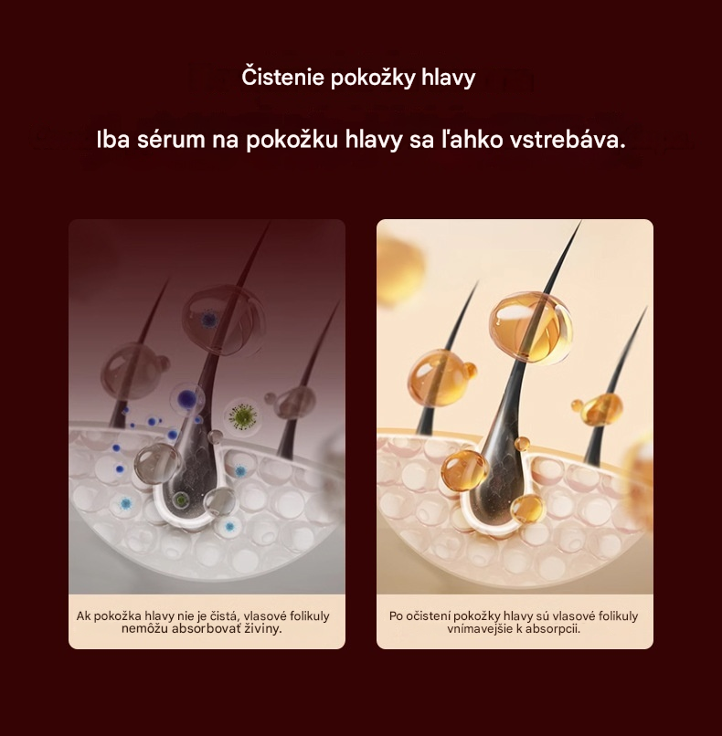 🥇【50% zľava】💆‍♀️Hrebeň na masáž pokožky hlavy, multifunkčný aplikátor esenciálnych olejov a zariadenie na rast vlasov